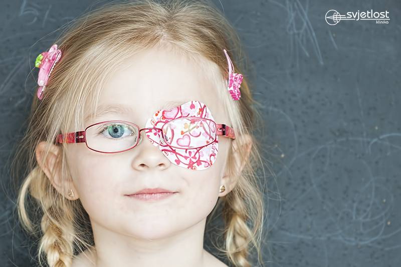 Znate li kako možemo liječiti najčešći poremećaj vida kod djece?